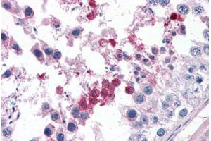 Human Testis: Formalin-Fixed, Paraffin-Embedded (FFPE) (Septin 3 Antikörper  (AA 15-26))