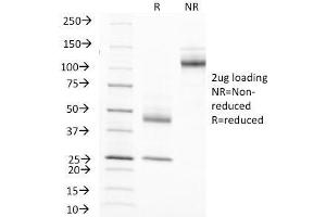 SDS-PAGE Analysis of Purified, BSA-Free EMA Antibody (clone MUC1/845). (MUC1 Antikörper)