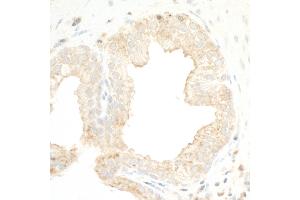 anti-Polycystic Kidney Disease 2 (Autosomal Dominant) (PKD2) (C-Term) antibody