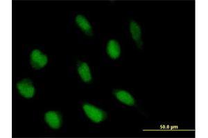 Immunofluorescence of purified MaxPab antibody to ABI2 on HeLa cell. (ABI2 Antikörper  (AA 1-475))