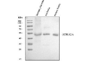 Western blot analysis of ADRA2A using anti-ADRA2A antibody (ABIN7600182).