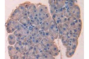 Detection of LOX in Mouse Pancreas Tissue using Polyclonal Antibody to Lysyl Oxidase (LOX) (LOX Antikörper  (AA 207-411))