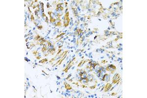 Immunohistochemistry of paraffin-embedded mouse lung using V antibody (ABIN6130774, ABIN6150046, ABIN6150047 and ABIN6224821) at dilution of 1:100 (40x lens). (VAMP1 Antikörper  (AA 1-96))