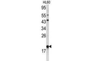 Image no. 1 for anti-Actin Related Protein 2/3 Complex, Subunit 3, 21kDa (ARPC3) (C-Term) antibody (ABIN452763) (ARPC3 Antikörper  (C-Term))