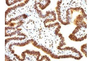 Image no. 3 for anti-Small Ubiquitin Related Modifier Protein 1 (SUMO1) antibody (ABIN6186913) (SUMO1 Antikörper)