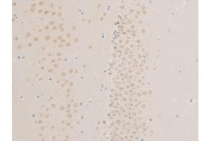 ABIN6267268 at 1/100 staining mouse brain tissue sections by IHC-P. (EGFR Antikörper  (pSer1026))