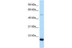 WB Suggested Anti-SARS2 Antibody Titration: 1. (SARS2 Antikörper  (N-Term))