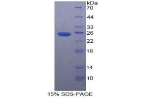 SDS-PAGE analysis of Human PK Protein. (PKLR Protein)