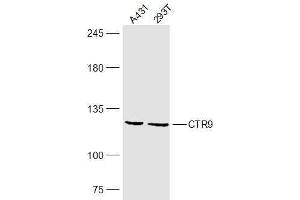 Lane 1: A431 lysates Lane 2: 293T lysates probed with CTR9 Polyclonal Antibody, Unconjugated  at 1:300 dilution and 4˚C overnight incubation. (CTR9 Antikörper  (AA 751-850))
