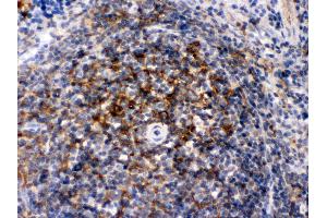 Immunohistochemistry (Paraffin-embedded Sections) (IHC (p)) image for anti-Actin, alpha 1, Skeletal Muscle (ACTA1) (AA 277-308), (C-Term) antibody (ABIN3043519) (Actin Antikörper  (C-Term))