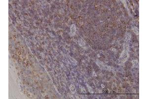 Image no. 1 for anti-ARP3 Actin-Related Protein 3 (ACTR3) (AA 1-419) antibody (ABIN599115) (ACTR3 Antikörper  (AA 1-419))