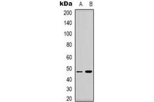 Western blot analysis of Lupus La (pS366) expression in HEK293T (A), MCF7 (B) whole cell lysates. (Lupus La (C-Term), (pSer366) Antikörper)