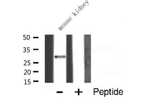 Western blot analysis of RPS4X expression in Mouse kidney lysate (RPS4X Antikörper  (Internal Region))