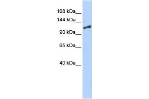 WB Suggested Antibody Titration: 0. (SMARCA1 Antikörper  (N-Term))