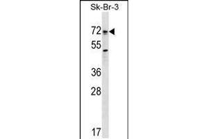 Western blot analysis in SK-BR-3 cell line lysates (35ug/lane). (BMPR1A Antikörper  (AA 170-197))