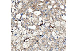 IHC analysis of Kindlin 2/FERMT2 using anti-Kindlin 2/FERMT2 antibody (ABIN7599515). (FERMT2 Antikörper  (AA 1-650))
