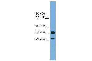 Western Blot showing CD8B antibody used at a concentration of 1-2 ug/ml to detect its target protein. (CD8B Antikörper  (Middle Region))