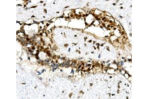 IHC analysis of U2AF2 using anti-U2AF2 antibody (ABIN7600793).
