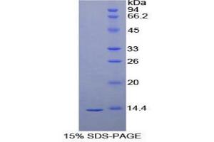 SDS-PAGE analysis of Human VEGFD Protein. (VEGFD Protein)