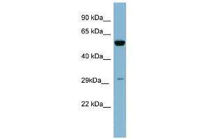 WB Suggested Anti-KLK10 Antibody Titration: 0. (Kallikrein 10 Antikörper  (N-Term))