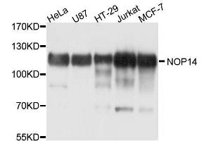 Western blot analysis of extracts of various cell lines, using NOP14 antibody. (Nop14 Antikörper  (AA 1-240))