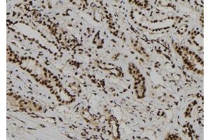 ABIN6266020 and ABIN6273186 at 1/100 staining Human kidney tissue by IHC-P. (WDR46 Antikörper  (Internal Region))
