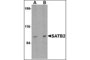 Western blot analysis of SATB2 in mouse brain tissue lysate with this product at (A) 2 and (B) 4 μg/ml. (SATB2 Antikörper  (N-Term))