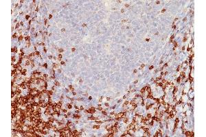 Formalin-fixed, paraffin-embedded human Tonsil stained with CD5 Mouse Monoclonal Antibody (C5/473). (CD5 Antikörper)