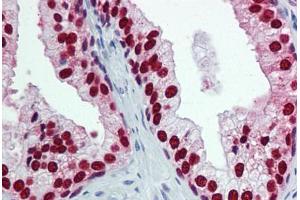 Human Prostate: Formalin-Fixed, Paraffin-Embedded (FFPE) (FOXA1 Antikörper  (AA 367-473))