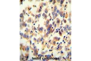 Immunohistochemistry (Paraffin-embedded Sections) (IHC (p)) image for anti-UDP Glycosyltransferase 3 Family, Polypeptide A2 (UGT3A2) (AA 384-413), (C-Term) antibody (ABIN955444)