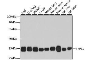 Western blot analysis of extracts of various cell lines, using PRPS1 antibody. (PRPS1 Antikörper)
