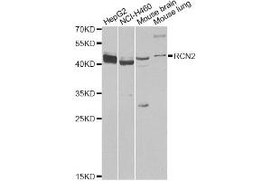 Western blot analysis of extracts of various cell lines, using RCN2 antibody (ABIN6293762) at 1:1000 dilution. (RCN2 Antikörper)