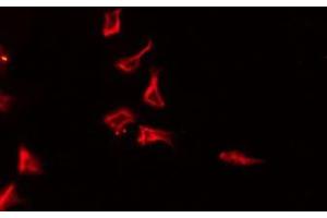 ABIN6275777 staining HeLa by IF/ICC. (IL-4 Antikörper  (Internal Region))