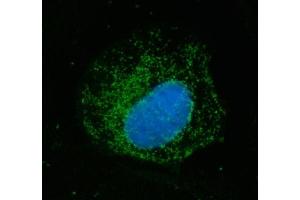 IF analysis of ECHS1 using anti-ECHS1 antibody (ABIN7599813).