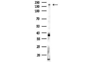 anti-B-Cell CLL/lymphoma 9-Like (BCL9L) antibody