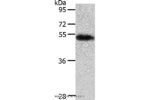 Western blot analysis of Human liver cancer tissue, using AGT Polyclonal Antibody at dilution of 1:700 (AGT Antikörper)