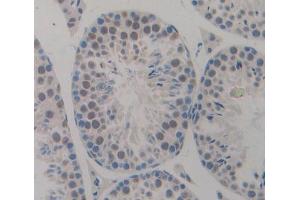 Used in DAB staining on fromalin fixed paraffin- embedded testis tissue (CDKN2D Antikörper  (AA 1-166))