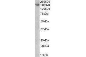AP22427PU-N AGTPBP1 antibody staining of HeLa lysate at 1 µg/ml (35µg protein in RIPA buffer). (AGTPBP1 Antikörper  (Internal Region))