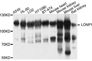 Western blot analysis of extracts of various cell lines, using LONP1 antibody. (LONP1 Antikörper)