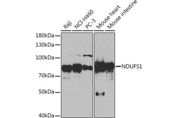 NDUFS1 Antikörper  (AA 80-290)