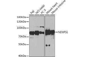 Western blot analysis of extracts of various cell lines, using NDUFS1 Rabbit pAb (ABIN7268819) at 1:1000 dilution.