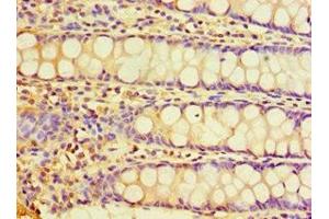 Immunohistochemistry of paraffin-embedded human colon tissue using ABIN7147675 at dilution of 1:100 (CHRFAM7A Antikörper  (AA 1-150))