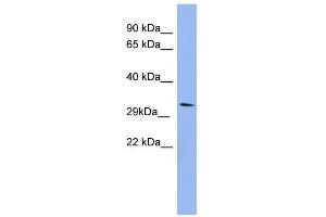 WB Suggested Anti-RRAD Antibody Titration: 0. (RRAD Antikörper  (Middle Region))