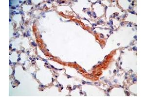 Immunohistochemistry (IHC) image for anti-Cathelicidin Antimicrobial Peptide (CAMP) (AA 140-173) antibody (ABIN2873275)