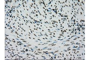 Image no. 1 for anti-Premelanosome Protein (PMEL) antibody (ABIN1500300) (Melanoma gp100 Antikörper)