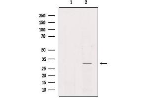 Western blot analysis of extracts from Hela, using NKX62 Antibody. (NKX6-2 Antikörper)