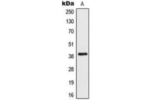 Western blot analysis of AIM2 expression in Jurkat (A) whole cell lysates.