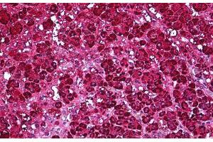 Human Adrenal: Formalin-Fixed, Parraffin-Embedded (FFPE) (Ferredoxin Reductase Antikörper)