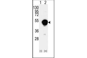 Western blot analysis of CYP20A1(arrow) using rabbit polyclonal CYP20A1 Antibody