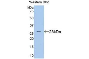 Detection of Recombinant TMEM173, Human using Polyclonal Antibody to Transmembrane Protein 173 (TMEM173) (STING/TMEM173 Antikörper  (AA 159-373))